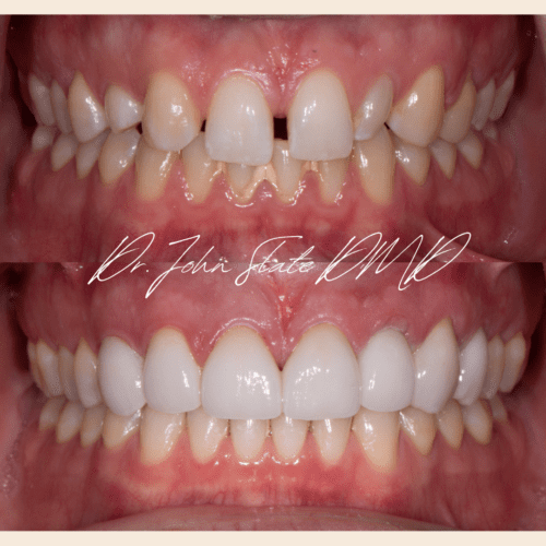 Multidisciplinary reconstruction alternative view