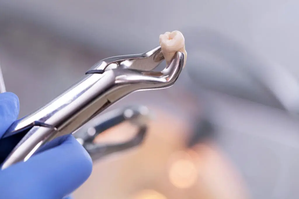 Understanding when you might need a tooth extraction could ease your concerns and help you make informed decisions about your oral health.