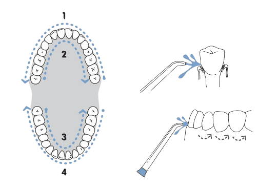 How to use a water pic Washington DC