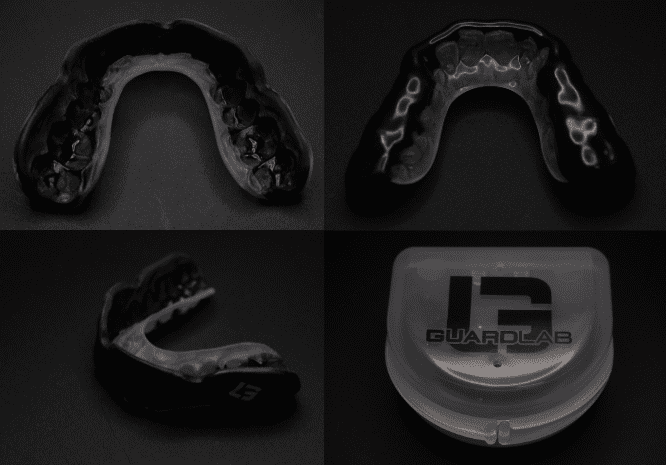 Custom Mouthguard in Washington DC