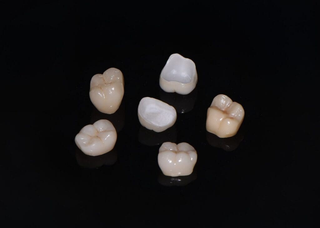 A close-up, artistic photograph of six individual, tooth-colored ceramic dental crowns resting on a dark, highly reflective surface.